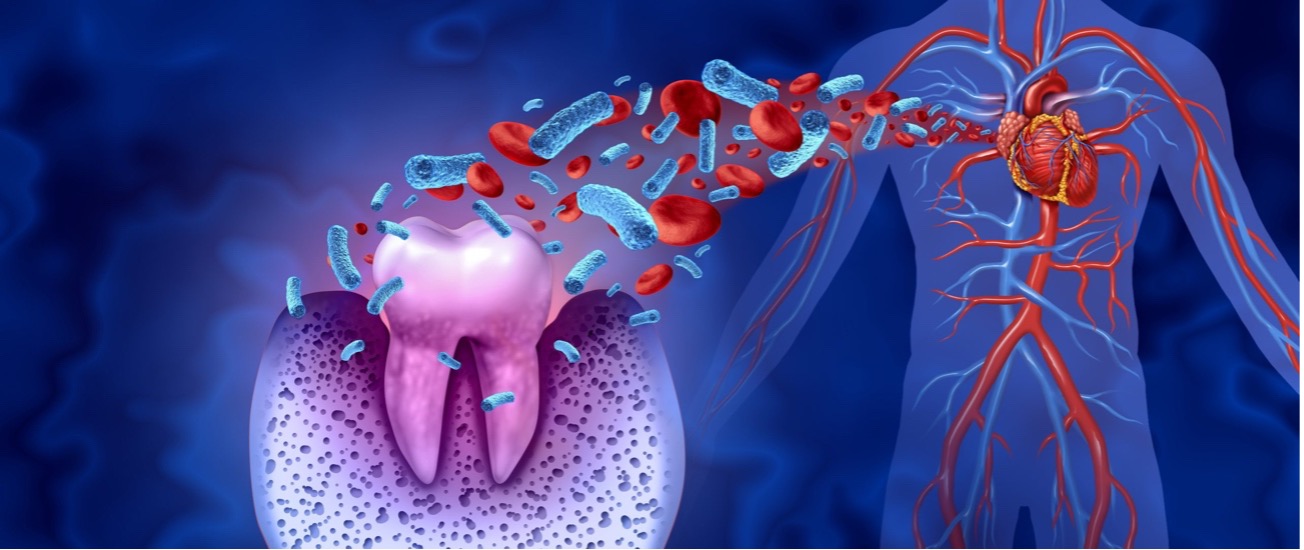 Heart Disease and Its Relationship with Oral Health