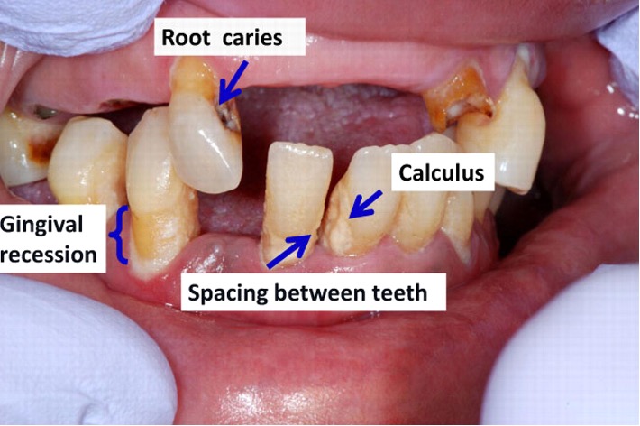 Diabetes and Your Oral Care: Your Guide to Total Health and Wellness