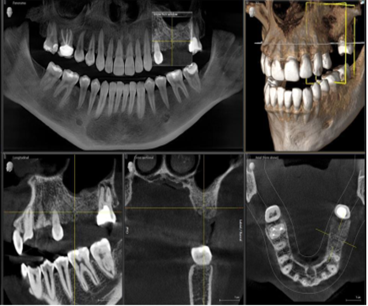 Diagnosis: The Key to Success in Dental Treatment