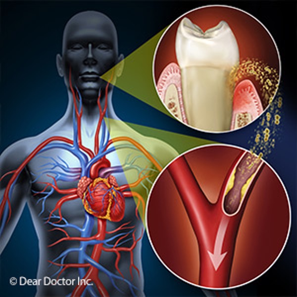 The Connection Between Gum Health and Heart Disease