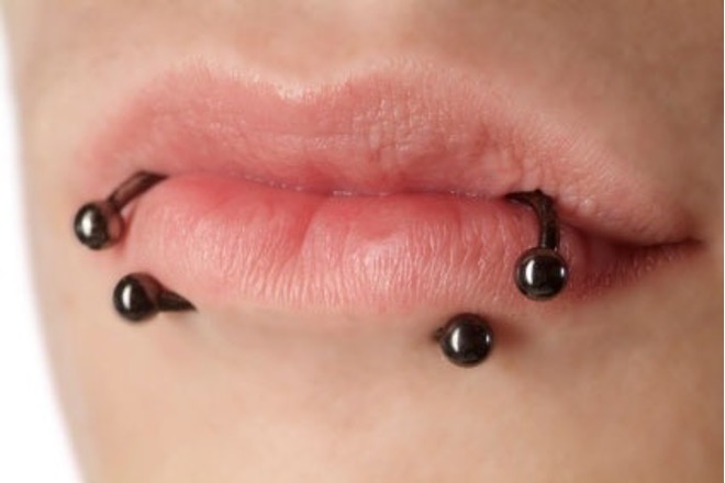 The Hidden Dangers of Tongue and Lip Piercing and Dental Bling