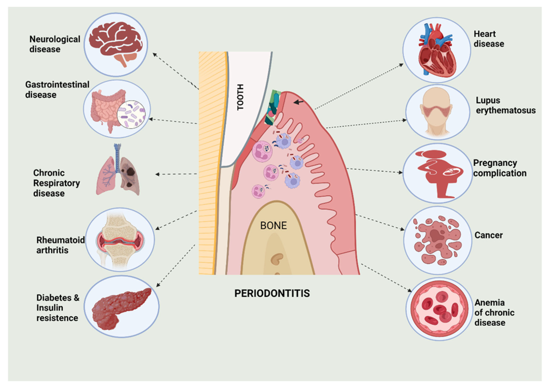 How Gum Disease Can Affect Your Lungs and Brain