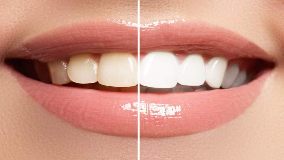 How Cosmetic Dentistry Can Enhance Your Life